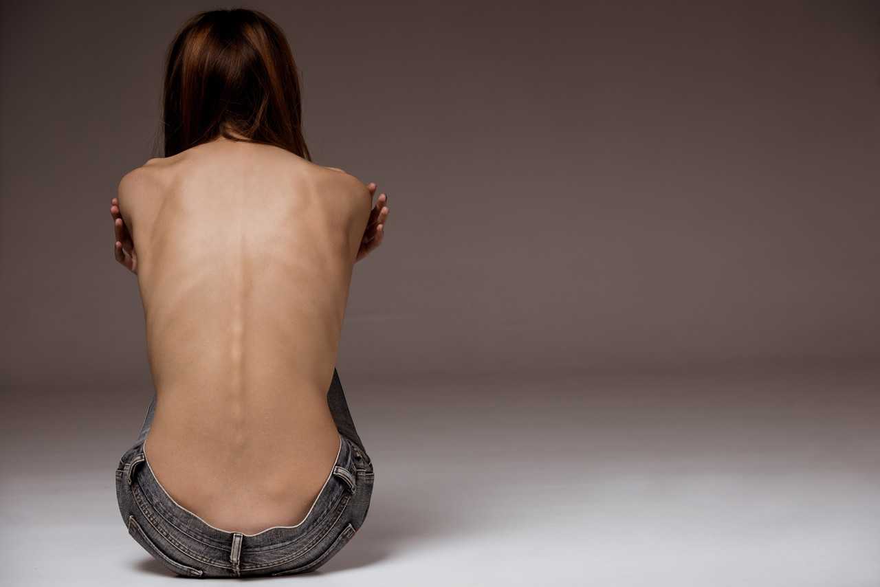 Anorexia o medo de crescer